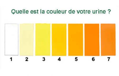 Allez voir un médecin immédiatement si votre urine est comme ça.