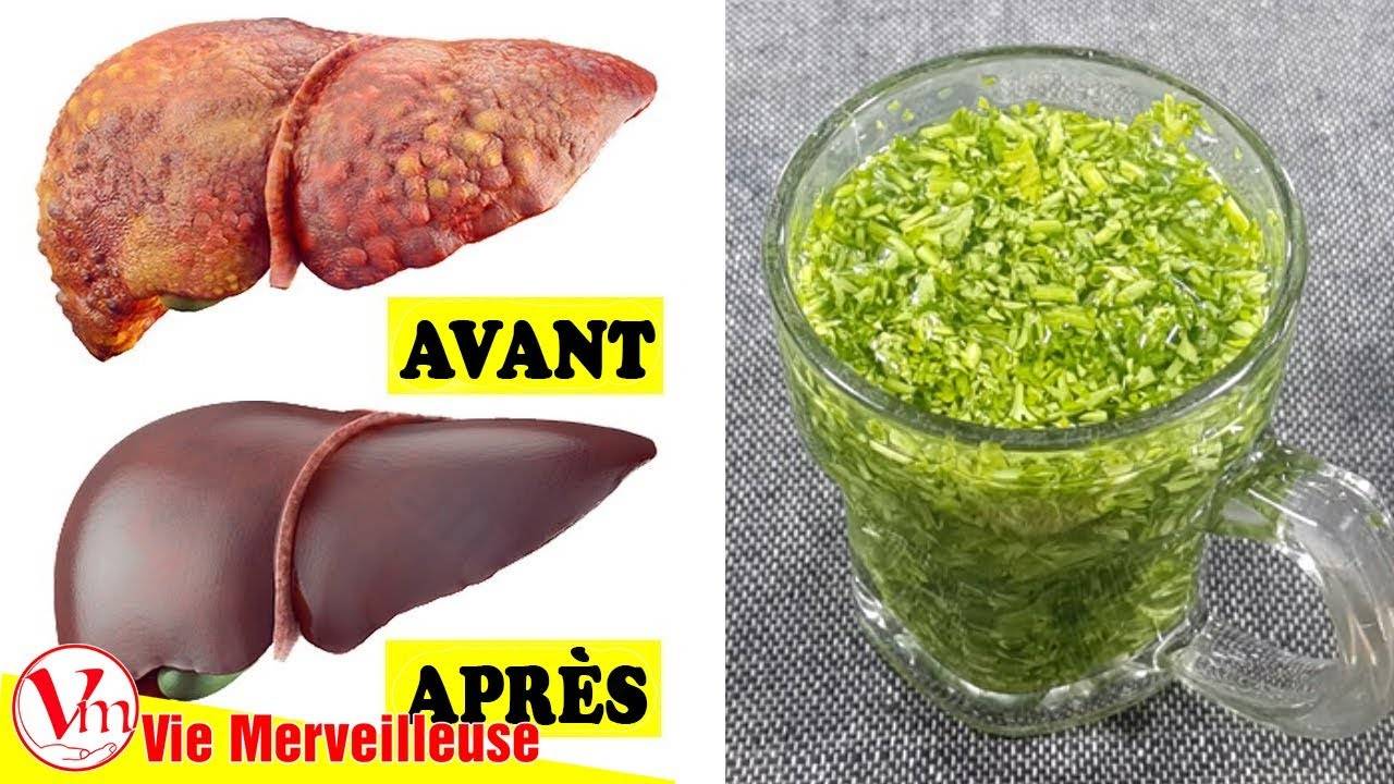 Ainsi, vous pouvez nettoyer les reins avec du persil